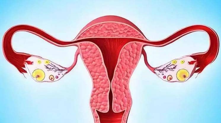多囊卵巢综合征做试管婴儿，成功率有多高？