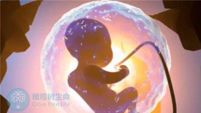 试管婴儿移植后，保质保量完成才是真正的“助成功”！