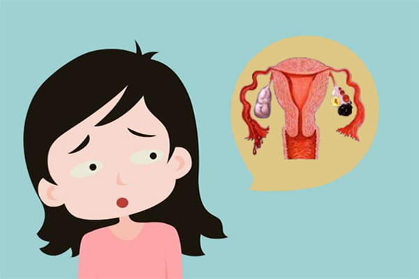 巧克力囊肿患者去泰国做试管婴儿，好孕有保障吗？