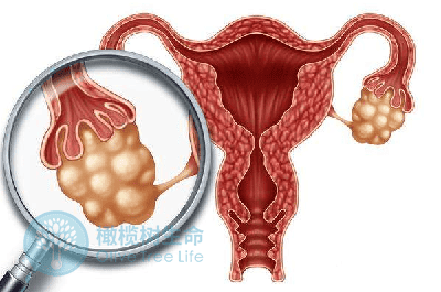 泰国德宏试管婴儿:如何杜绝促排卵对女性造成的伤害?