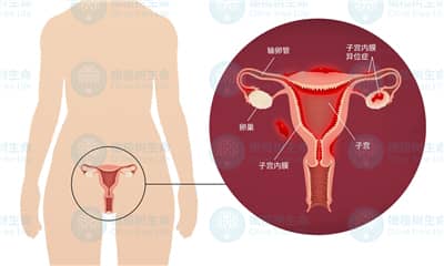 子宫内膜变薄后有哪些危害？是否能做德宏试管婴儿？