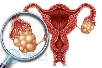卵泡发育不成熟，泰国泰安试管婴儿促排能解决吗？