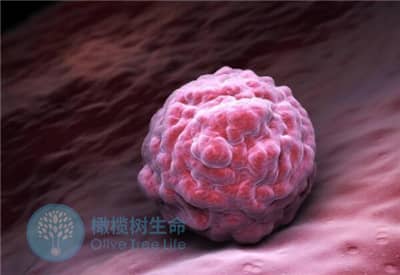 泰国德宏试管婴儿胚胎移植后的常见问题