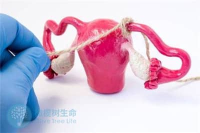 做泰安试管婴儿有必要结扎输卵管来避免宫外孕吗？