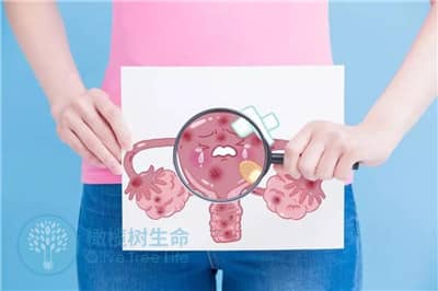 有卵巢囊肿和输卵管积水，能做德宏试管婴儿吗？