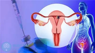子宫内膜容受性差，如何提高试管成功率？