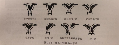 胎停、流产……为什么总是找上你？