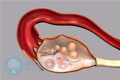 促黄体生成素为何会导致排卵障碍，该如何调理