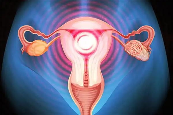 渝北做试管婴儿前如何调养子宫-提高好孕率？